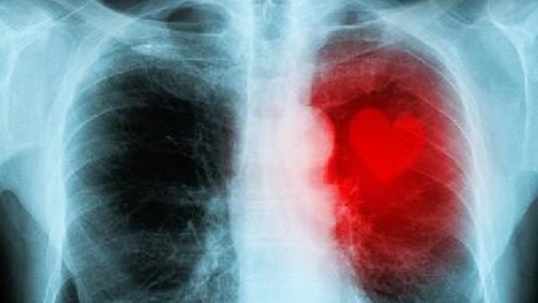 肺炎的主要危害有哪些