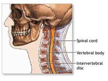 颈部脊髓震荡