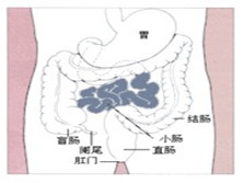 短肠综合征