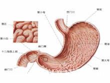 急性胃粘膜病变