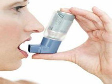 阿司匹林诱发哮喘