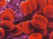 相对性红细胞增多症