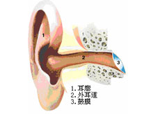 外耳脓肿