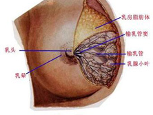 乳管内乳头状瘤