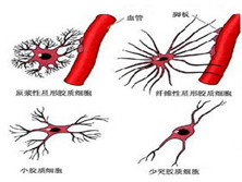 单克隆丙种球蛋白病伴周围神经病