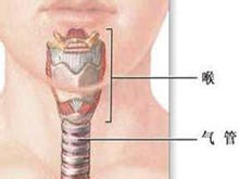喉气管瘢痕性狭窄