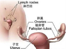 卵巢卵黄囊瘤
