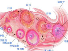 卵泡腺细胞增殖综合征