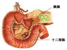 胰腺囊肿