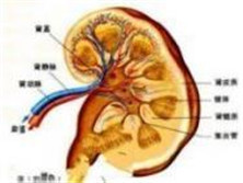 肾异位血管及副血管