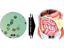 急性弥漫性腹膜炎