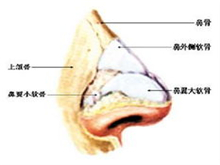 咽部硬结病