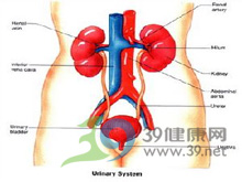 特发性尿钙增多症