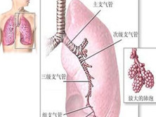 堪萨斯分枝杆菌感染