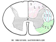 躯体感觉障碍