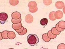 婴儿期短暂性低丙球蛋白血症
