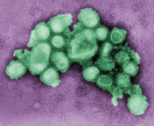 甲型H1N1流感(猪流感)