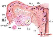 卵巢冠囊肿