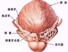 淋病合并精囊炎