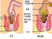 阴结