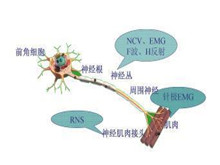 遗传性运动失调性多发性神经炎