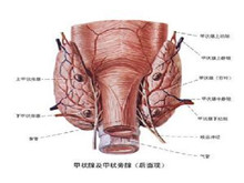 原发性甲状腺恶性淋巴瘤